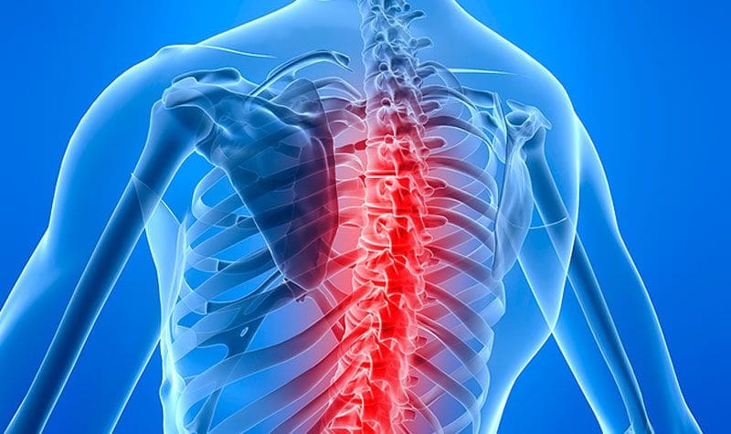 Spinal Cord Stimulator Lawsuit